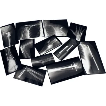 Fixed Bones X-Rays - Set of 14 Cards